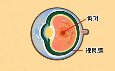 愛爾眼科：激光“打”在眼內(nèi)還能治眼病？(圖3)