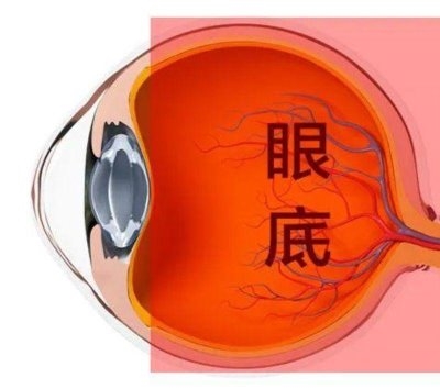 愛爾眼科：激光“打”在眼內(nèi)還能治眼?。?/></a>          <h3><a href=