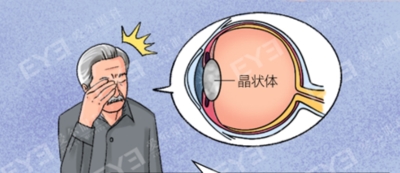 愛爾眼科：白內障不會“缺席”只會“遲到”？(圖2)